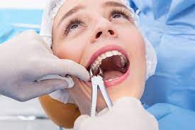 Surgical Tooth Extraction​
